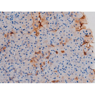 AKT1 Antibody - 1:200 staining mouse pancreas tissue by IHC-P. The tissue was formaldehyde fixed and a heat mediated antigen retrieval step in citrate buffer was performed. The tissue was then blocked and incubated with the antibody for 1.5 hours at 22°C. An HRP conjugated goat anti-rabbit antibody was used as the secondary.