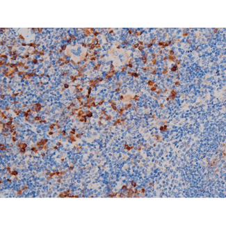 AKT1 Antibody - 1:200 staining mouse spleen tissue by IHC-P. The tissue was formaldehyde fixed and a heat mediated antigen retrieval step in citrate buffer was performed. The tissue was then blocked and incubated with the antibody for 1.5 hours at 22°C. An HRP conjugated goat anti-rabbit antibody was used as the secondary.