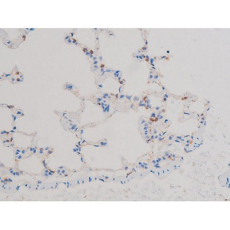 AKT1 Antibody - 1:200 staining rat lung tissue by IHC-P. The tissue was formaldehyde fixed and a heat mediated antigen retrieval step in citrate buffer was performed. The tissue was then blocked and incubated with the antibody for 1.5 hours at 22°C. An HRP conjugated goat anti-rabbit antibody was used as the secondary.