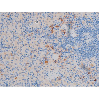 AKT1 Antibody - 1:200 staining rat spleen tissue by IHC-P. The tissue was formaldehyde fixed and a heat mediated antigen retrieval step in citrate buffer was performed. The tissue was then blocked and incubated with the antibody for 1.5 hours at 22°C. An HRP conjugated goat anti-rabbit antibody was used as the secondary.