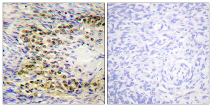 AKT1 Antibody - Immunohistochemistry analysis of paraffin-embedded human ovary, using Akt (Phospho-Thr72) Antibody. The picture on the right is blocked with the phospho peptide.