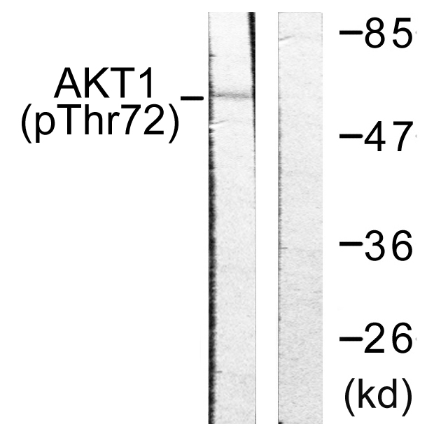 AKT1 Antibody - Western blot analysis of lysates from NIH/3T3 cells treated with TNF-a 20ng/ml 30', using Akt (Phospho-Thr72) Antibody. The lane on the right is blocked with the phospho peptide.