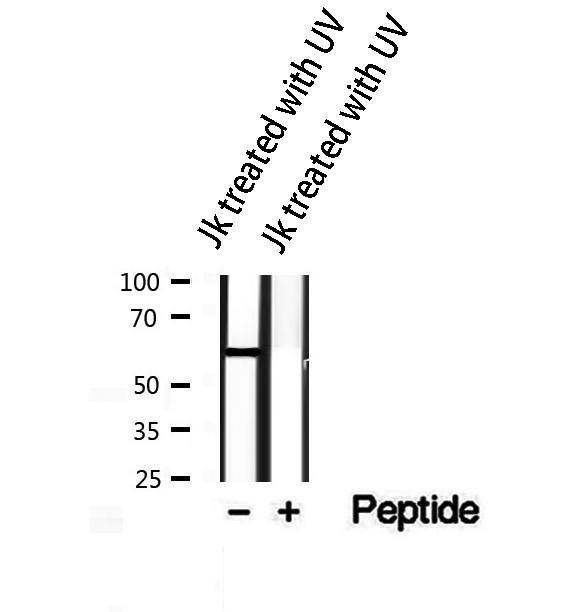 AKT1 Antibody - Western blot analysis of extracts of JK treated with UV using Phospho-AKT1/2/3(Tyr315/316/312) antibody.