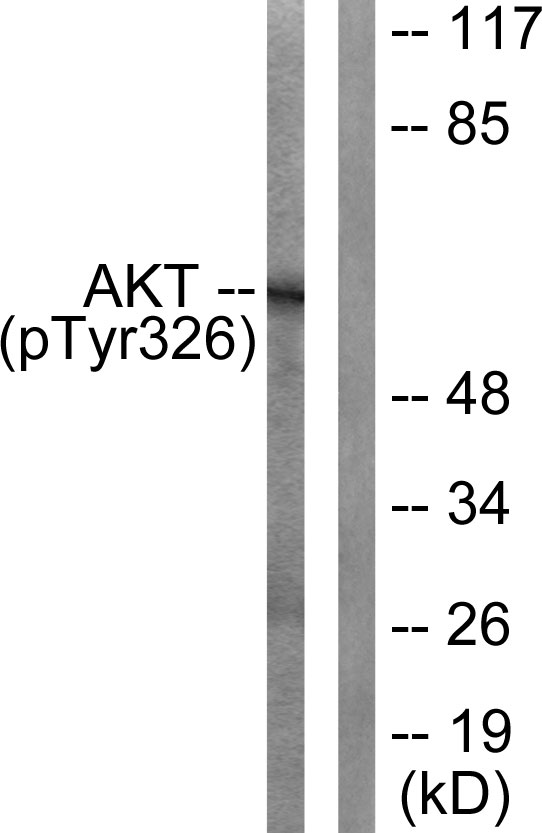 AKT1 Antibody - Western blot analysis of lysates from mouse liver, using Akt (Phospho-Tyr326) Antibody. The lane on the right is blocked with the phospho peptide.
