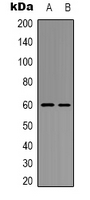 AKT1 Antibody - Western blot analysis of AKT (pY326) expression in HEK293T (A); mouse liver (B) whole cell lysates.