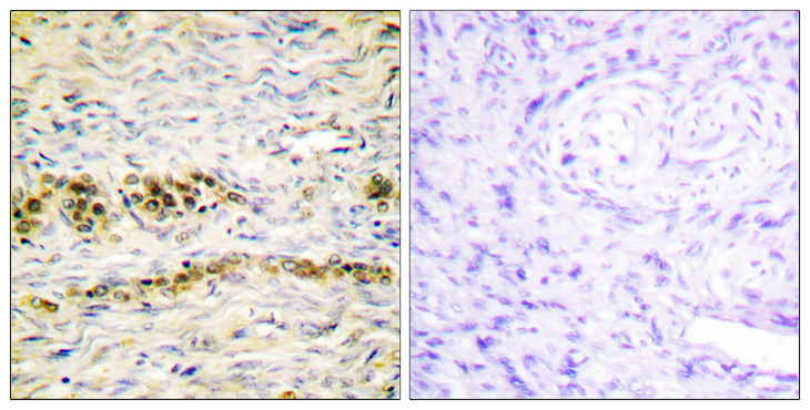 AKT1 Antibody - Immunohistochemistry analysis of paraffin-embedded human ovary, using Akt (Phospho-Tyr474) Antibody. The picture on the right is blocked with the phospho peptide.