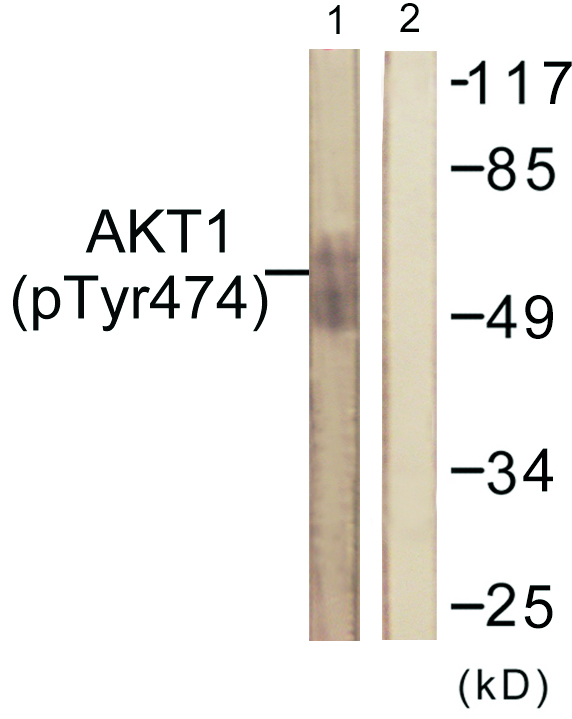 AKT1 Antibody - Western blot analysis of lysates from COS7 cells treated with UV 15', using Akt (Phospho-Tyr474) Antibody. The lane on the right is blocked with the phospho peptide.
