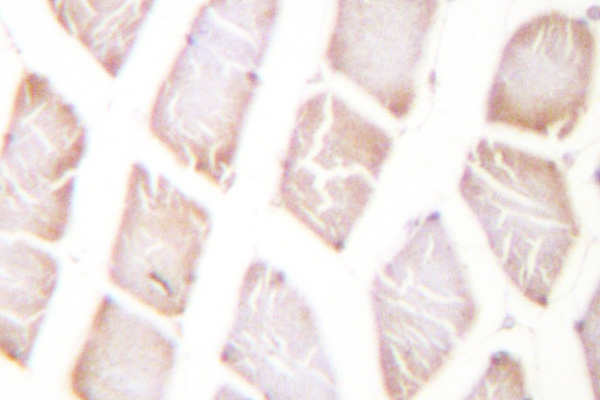 AKT1 Antibody - IHC of Akt (P125) pAb in paraffin-embedded human skeletal muscle tissue.