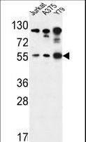 AKT1 Antibody - AKT1-S129 antibody western blot of Jurkat,A375,Y79 cell line lysates (35 ug/lane). The AKT1 antibody detected the AKT1 protein (arrow).