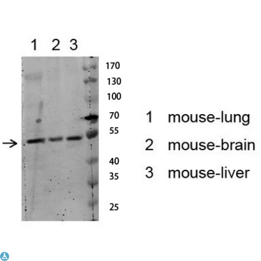AKT1 Antibody - Western blot analysis of various lysate, antibody was diluted at 1000. Secondary antibody was diluted at 1:20000.