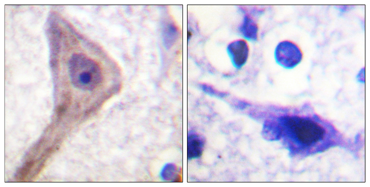 AKT1S1 / PRAS40 Antibody - Immunohistochemistry analysis of paraffin-embedded human brain tissue, using Akt1 S1 Antibody. The picture on the right is blocked with the synthesized peptide.