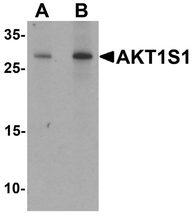 AKT1S1 / PRAS40 Antibody - Western blot analysis of AKT1S1 in human brain tissue lysate with AKT1S1 antibody at (A) 1 and (B) 2 ug/ml.