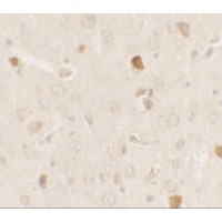 AKT1S1 / PRAS40 Antibody - Immunohistochemistry of AKT1S1 in rat brain tissue with AKT1S1 antibody at 2.5 µg/ml.