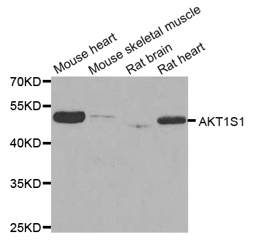 AKT1S1 / PRAS40 Antibody - Western blot analysis of extracts of various cell lines.