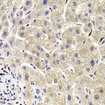 AKT1S1 / PRAS40 Antibody - Immunohistochemistry of paraffin-embedded Human liver injury tissue.