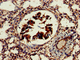 AKT1S1 / PRAS40 Antibody - Immunohistochemistry of paraffin-embedded human lung tissue at dilution of 1:100