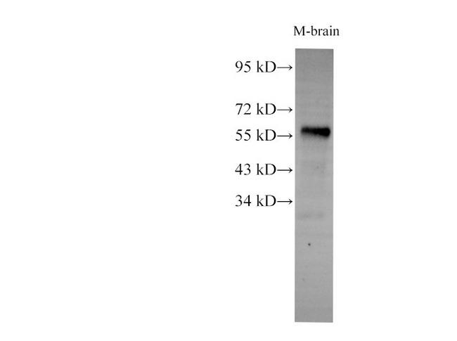 AKT1S1 / PRAS40 Antibody - Western Blot analysis of Mouse brain using AKT1S1 Polyclonl Antibody at dilution of 1:2000.