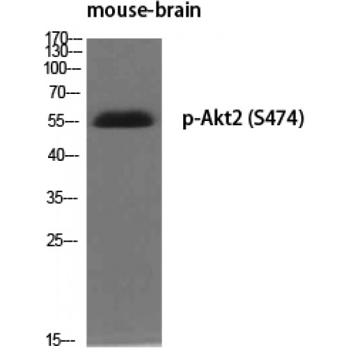 AKT2 Antibody - Western blot of Phospho-Akt2 (S474) antibody