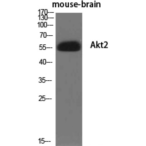 AKT2 Antibody - Western blot of Akt2 antibody