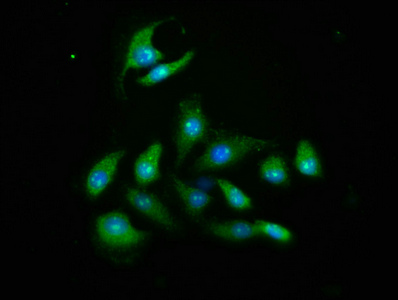 AKT2 Antibody - Immunofluorescence staining of A549 cells with AKT2 Antibody at 1:466, counter-stained with DAPI. The cells were fixed in 4% formaldehyde, permeabilized using 0.2% Triton X-100 and blocked in 10% normal Goat Serum. The cells were then incubated with the antibody overnight at 4°C. The secondary antibody was Alexa Fluor 488-congugated AffiniPure Goat Anti-Rabbit IgG(H+L).