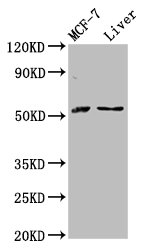 AKT2 Antibody - Western Blot Positive WB detected in: MCF-7 whole cell lysate, Rat liver tissue All lanes: AKT2 antibody at 2.8µg/ml Secondary Goat polyclonal to rabbit IgG at 1/50000 dilution Predicted band size: 56, 52 kDa Observed band size: 56 kDa