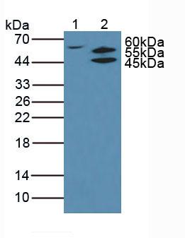 AKT2 Antibody - Western Blot; Sample: Lane1: Human K562 Cells; Lane2: Rat Thyroid Gland Tissue.