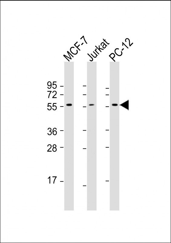 AKT2 Antibody - All lanes: Anti-AKT2 Antibody at 1:1000-1:2000 dilution. Lane 1: MCF-7 whole cell lysate. Lane 2: Jurkat whole cell lysate. Lane 3: PC-12 whole cell lysate Lysates/proteins at 20 ug per lane. Secondary Goat Anti-mouse IgG, (H+L), Peroxidase conjugated at 1:10000 dilution. Predicted band size: 56 kDa. Blocking/Dilution buffer: 5% NFDM/TBST.