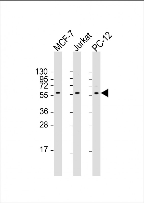 AKT2 Antibody - All lanes: Anti-AKT2 Antibody at 1:2000 dilution. Lane 1: MCF-7 whole cell lysate. Lane 2: Jurkat whole cell lysate. Lane 3: PC-12 whole cell lysate Lysates/proteins at 20 ug per lane. Secondary Goat Anti-mouse IgG, (H+L), Peroxidase conjugated at 1:10000 dilution. Predicted band size: 56 kDa. Blocking/Dilution buffer: 5% NFDM/TBST.