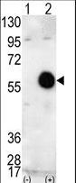 AKT2 Antibody - Western blot of AKT2 (arrow) using AKT2 Antibody. 293 cell lysates (2 ug/lane) either nontransfected (Lane 1) or transiently transfected with the AKT2 gene (Lane 2) (Origene Technologies).