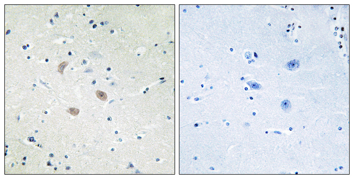 AKT2 Antibody - Immunohistochemistry analysis of paraffin-embedded human brain tissue, using Akt2 Antibody. The picture on the right is blocked with the synthesized peptide.