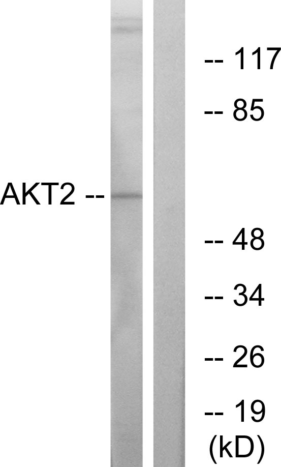 AKT2 Antibody - Western blot analysis of lysates from A2780 cells, treated with TNF-Î±, using Akt2 Antibody. The lane on the right is blocked with the synthesized peptide.