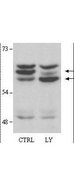 AKT2 Antibody - Anti-AKT2 Antibody - Western Blot. Antibody to AKT2 detects both unphosphorylated and phosphorylated AKT2 in Western blot. As before approximately 20 mg/lane of crude HEK293 lysate was loaded for SDS-PAGE, separated and then transferred to nitrocellulose. The right lane contains lysate pretreated for 15min with 25 uM LY294002 which affects the phosphorylation of endogenous Akt2 but has no effect on phosphorylation of the myristoylated construct. This antibody clearly detects both the phosphorylated (top arrow) and the non-phosphorylated (bottom arrow) forms of endogenous Akt2.