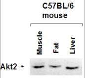 AKT2 Antibody - Anti-AKT2 Antibody - Western Blot. Affinity Purified antibody to AKT2 was used at a 1:1000 dilution to detect AKT2 by Western blot of lysates from mouse tissues. The antibody is shown to react with mouse Akt2 in mouse liver, skeletal muscle and fat using standard western blotting methods.