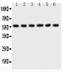 AKT2 Antibody - Western blot - Anti-AKT2 Picoband Antibody