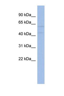 AKT2 Antibody - AKT2 antibody Western blot of 3 Cell lysate. Antibody concentration 1 ug/ml. This image was taken for the unconjugated form of this product. Other forms have not been tested.