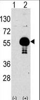 AKT2 Antibody - Western blot of anti-AKT2 Antibody antibody in 293 cell line lysates transiently transfected with the AKT2 gene (2 ug/lane). AKT2(arrow) was detected using the purified antibody.