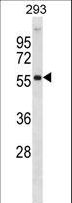 AKT2 Antibody - AKT2 Antibody (N108) western blot of 293 cell line lysates (35 ug/lane). The AKT2 antibody detected the AKT2 protein (arrow).