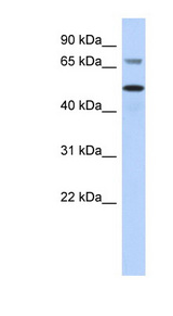 AKT2 Antibody - AKT2 antibody Western blot of MCF7 cell lysate. This image was taken for the unconjugated form of this product. Other forms have not been tested.