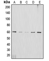 AKT2 Antibody - Western blot analysis of AKT2 expression in HeLa (A); HepG2 (B); NIH3T3 (C); mouse brain (D); rat brain (E) whole cell lysates.
