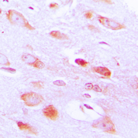 AKT2 Antibody - Immunohistochemical analysis of AKT2 staining in human brain formalin fixed paraffin embedded tissue section. The section was pre-treated using heat mediated antigen retrieval with sodium citrate buffer (pH 6.0). The section was then incubated with the antibody at room temperature and detected using an HRP conjugated compact polymer system. DAB was used as the chromogen. The section was then counterstained with hematoxylin and mounted with DPX.