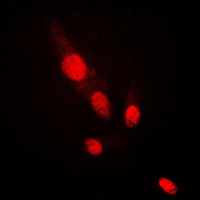AKT2 Antibody - Immunofluorescent analysis of AKT2 staining in HepG2 cells. Formalin-fixed cells were permeabilized with 0.1% Triton X-100 in TBS for 5-10 minutes and blocked with 3% BSA-PBS for 30 minutes at room temperature. Cells were probed with the primary antibody in 3% BSA-PBS and incubated overnight at 4 C in a humidified chamber. Cells were washed with PBST and incubated with a DyLight 594-conjugated secondary antibody (red) in PBS at room temperature in the dark. DAPI was used to stain the cell nuclei (blue).