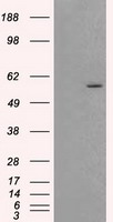 AKT2 Antibody - HEK293T cells were transfected with the pCMV6-ENTRY control (Left lane) or pCMV6-ENTRY AKT2 (Right lane) cDNA for 48 hrs and lysed. Equivalent amounts of cell lysates (5 ug per lane) were separated by SDS-PAGE and immunoblotted with anti-AKT2.