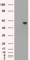 AKT2 Antibody - HEK293T cells were transfected with the pCMV6-ENTRY control (Left lane) or pCMV6-ENTRY AKT2 (Right lane) cDNA for 48 hrs and lysed. Equivalent amounts of cell lysates (5 ug per lane) were separated by SDS-PAGE and immunoblotted with anti-AKT2.