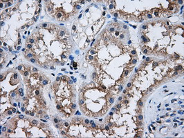 AKT2 Antibody - IHC of paraffin-embedded Kidney tissue using anti-AKT2 mouse monoclonal antibody. (Dilution 1:50).