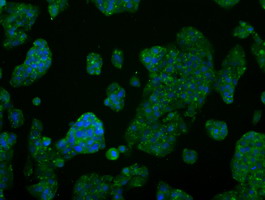 AKT2 Antibody - Immunofluorescent staining of HepG2 cells using anti-AKT2 mouse monoclonal antibody.
