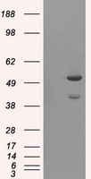 AKT2 Antibody - HEK293T cells were transfected with the pCMV6-ENTRY control (Left lane) or pCMV6-ENTRY AKT2 (Right lane) cDNA for 48 hrs and lysed. Equivalent amounts of cell lysates (5 ug per lane) were separated by SDS-PAGE and immunoblotted with anti-AKT2.