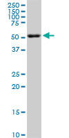 AKT2 Antibody - AKT2 monoclonal antibody (M06), clone X1. Western blot of AKT2 expression in PC-12.