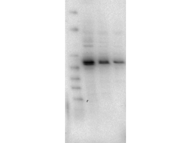 AKT2 Antibody - Western Blot of Rat Anti-AKT2 antibody. Lane 1: LnCap lysate Lane 2: Jurkat lysate. Lane 3: MDA-MB 468 lysate. Load: 5 µg per lane. Primary antibody: AKT2 unconjugated antibody at 1:1000 for overnight at 4°C. Secondary antibody: Rat secondary antibody at 1:20,000 for 45 min at RT. Block: 5% BLOTTO overnight at 4°C. Predicted/Observed size: 56 kDa for AKT2.