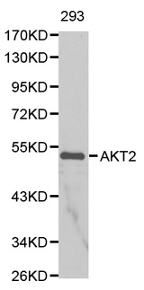 AKT2 Antibody - Western blot of AKT2 pAb in extracts from 293 cells.