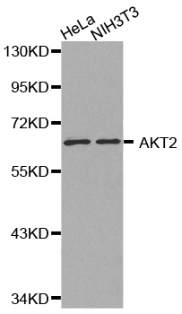 AKT2 Antibody - Western blot analysis of extracts of various cell lines, using AKT2 antibody. The secondary antibody used was an HRP Goat Anti-Rabbit IgG (H+L) at 1:10000 dilution. Lysates were loaded 25ug per lane and 3% nonfat dry milk in TBST was used for blocking.